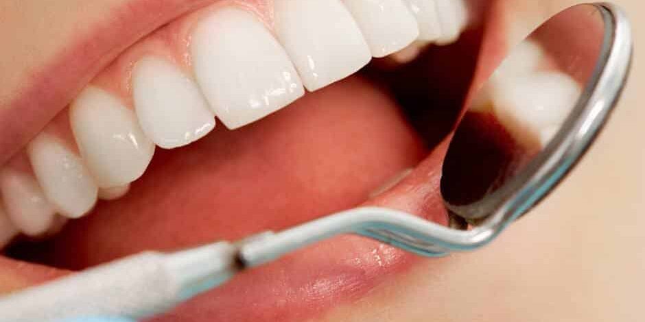 dentist-checking-teeth